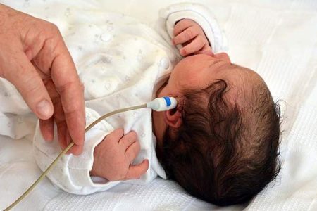 پوشش غربالگری شنوایی ۶۴ هزار نوزاد